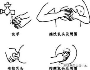 急性化膿性乳腺炎該如何預防